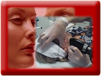 Laser Skin Resurfacing, Skin Rejuvenation and Resurfacing